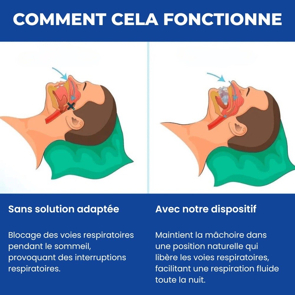 Lunaris™ - Solution efficace contre le ronflement et l’apnée du sommeil
